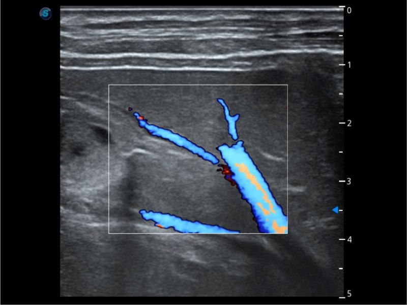 ProPet 60 Cart Based Color Doppler SonoScape